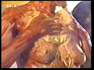 German TV - WAM Documentary