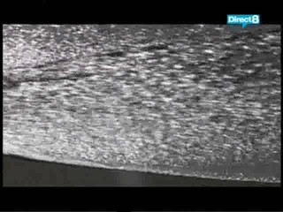 Bikini Contest Foto Session