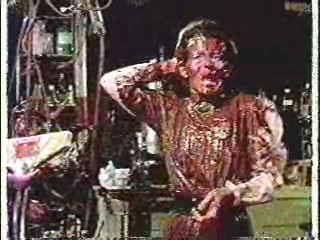 Anne of Green Gables,  Richard Bey Show